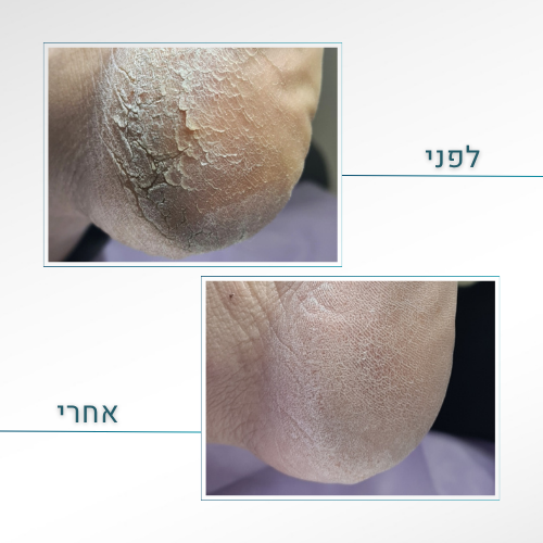 תמונה של טיפול